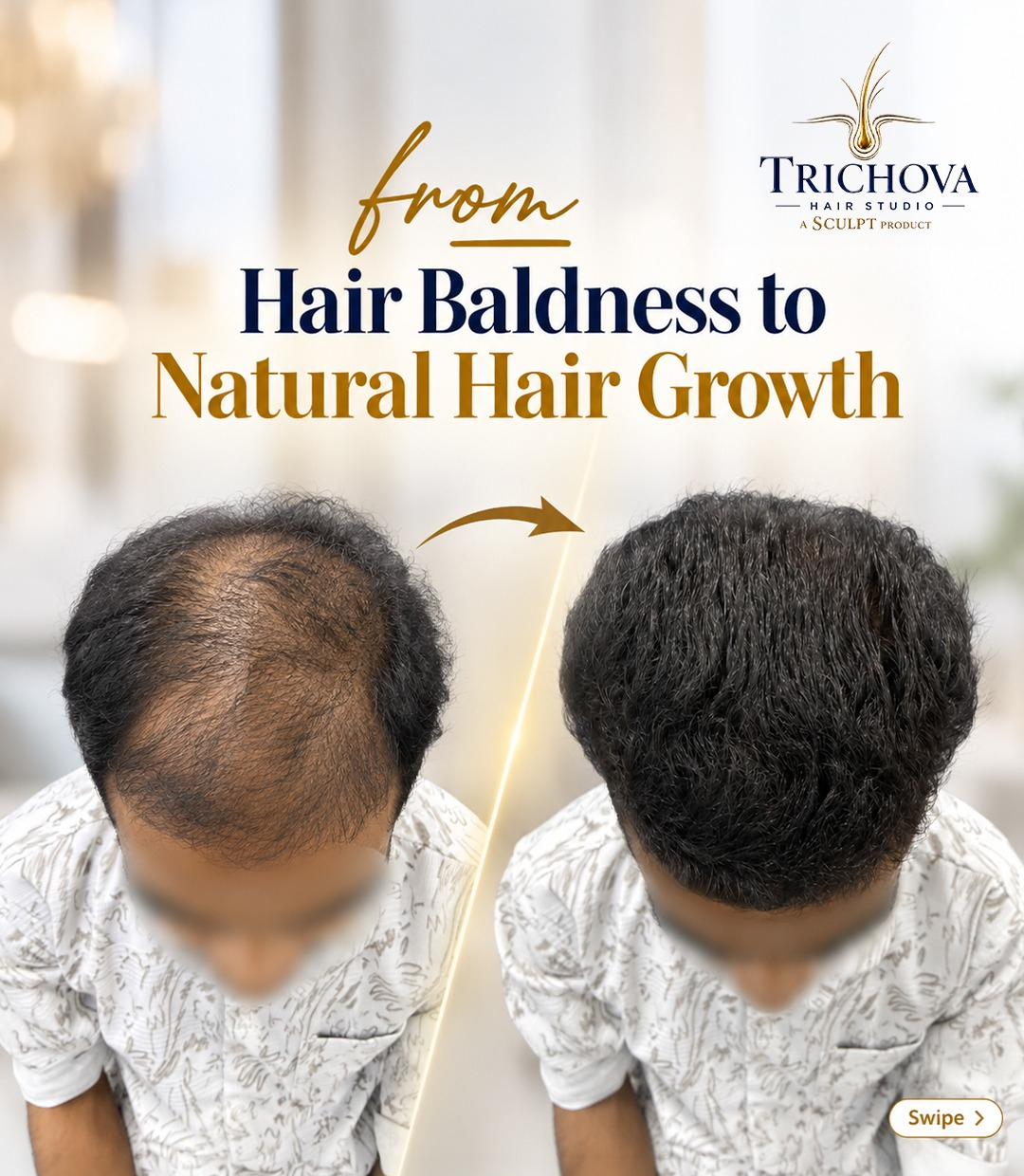 Natural Hair Growth